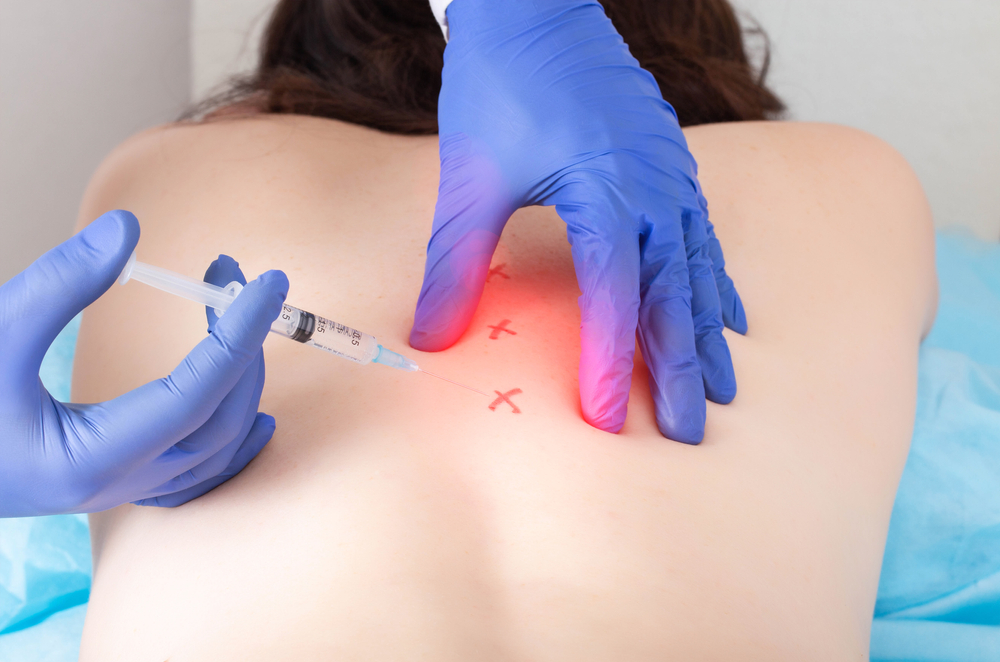 Trigger Point Injections New York