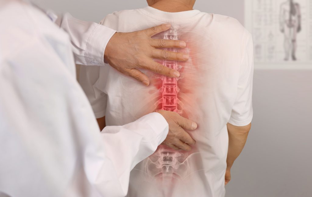 AdobeStock 992017219 - New York Spine Surgery