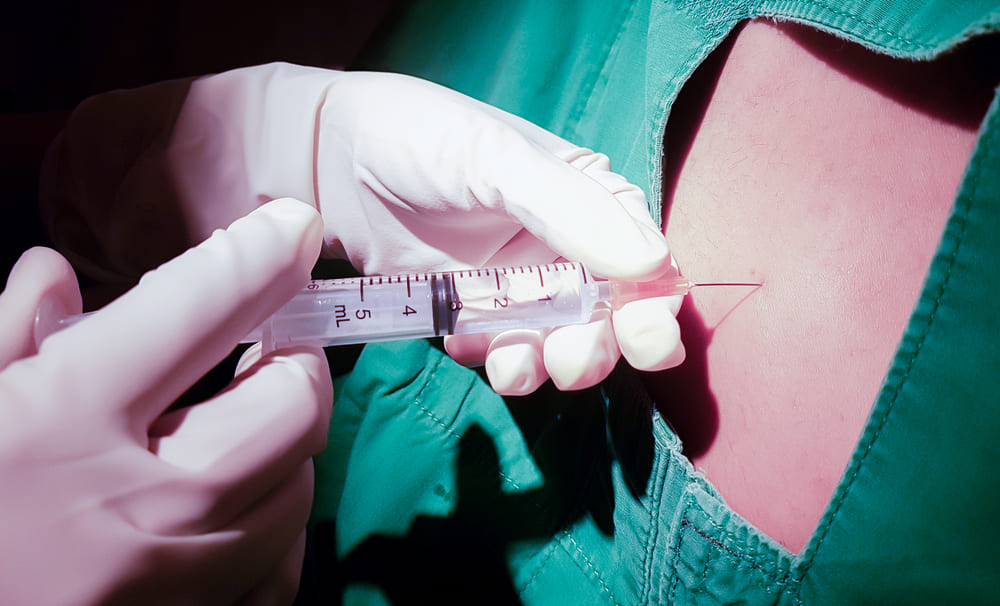Cervical Epidural Steroid Injections