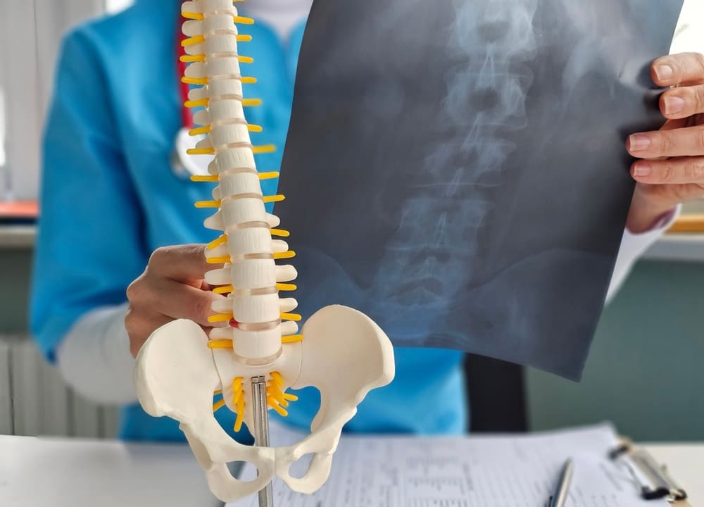 Revision Spine Surgery
